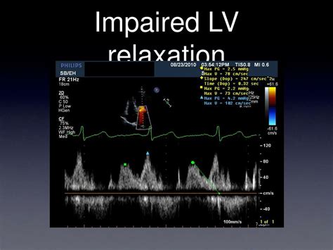 Lv systolic impairment